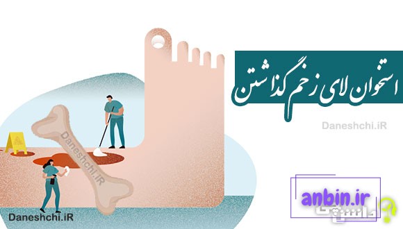 استخوان لای زخم گذاشتن 