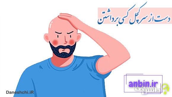 دست از سر کچل کسی برداشتن