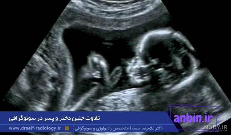 تشخیص جنسیت جنین از روی عکس و فیلم